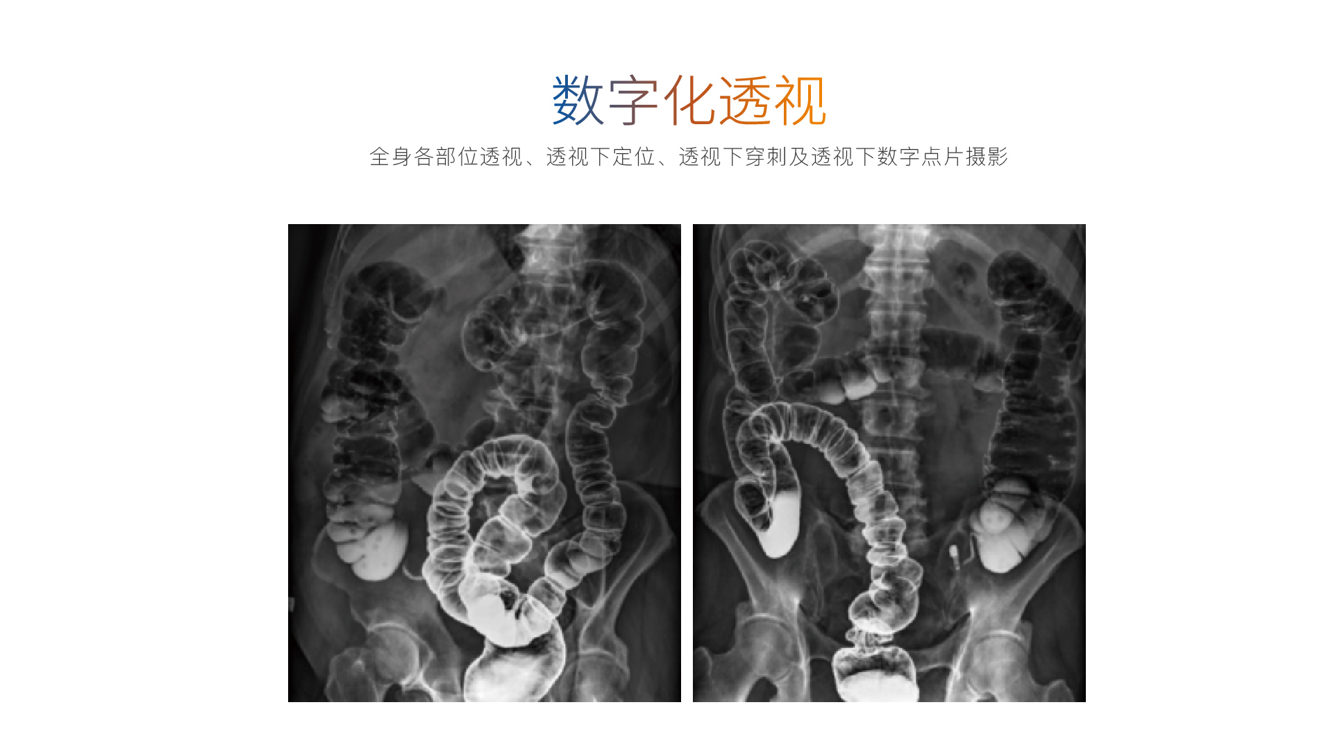 500-560落地页白背景-04.jpg