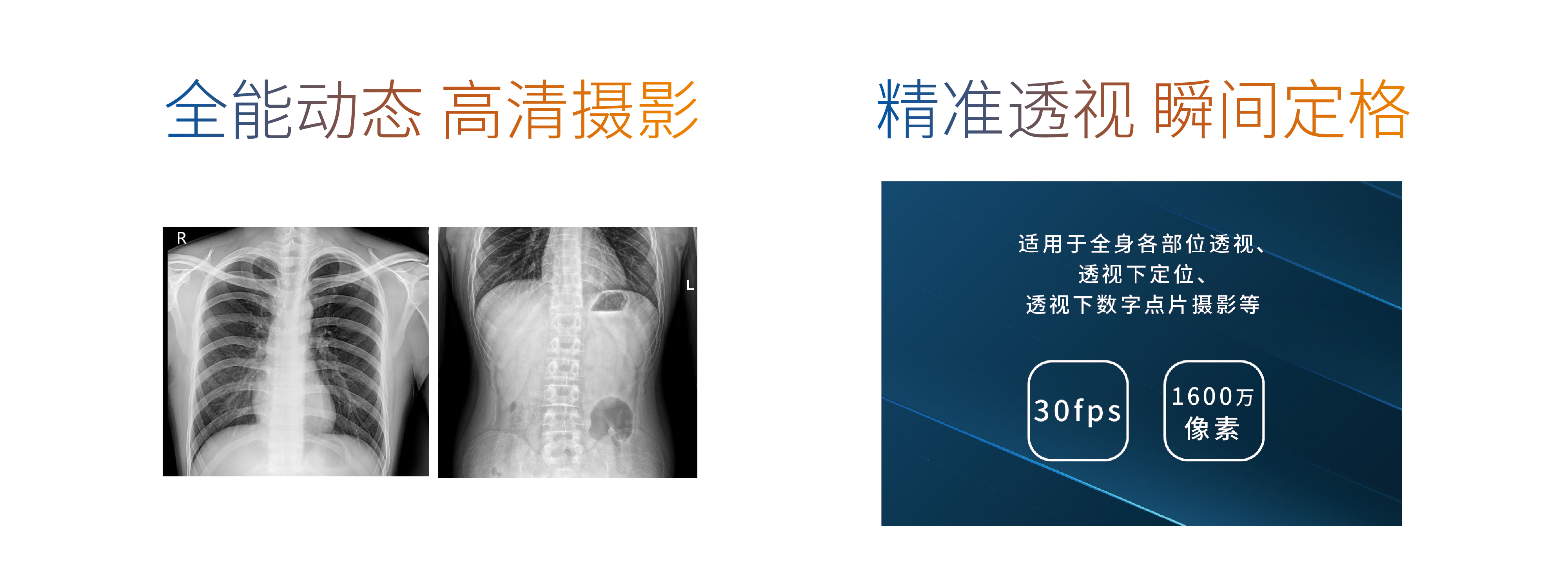 动态车载DR